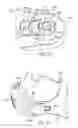 Fig. 52 - Ergonomic and adjustable respiratory mask assembly with headgear assembly