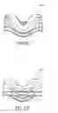 Fig. 57 - Ergonomic and adjustable respiratory mask assembly with headgear assembly