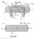 Fig. 05 - Apparatus and methods for treating sleep apnea