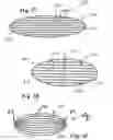 Fig. 06 - Apparatus and methods for treating sleep apnea