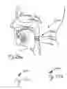 Fig. 12 - Apparatus and methods for treating sleep apnea