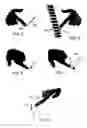 Fig. 03 - Nail veneer applique