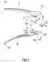 Fig. 03 - Hair clip