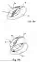 Fig. 08 - Cleaning process which uses ultrasonic waves