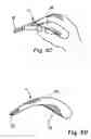Fig. 09 - Cleaning process which uses ultrasonic waves
