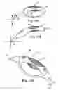 Fig. 16 - Cleaning process which uses ultrasonic waves