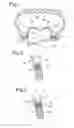 Fig. 02 - Tire/wheel assembly and run-flat support member