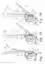 Fig. 08 - Motorized traction device for a patient support