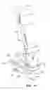 Fig. 41 - Motorized traction device for a patient support