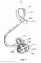 Fig. 02 - Beverage tap spout plug