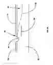 Fig. 03 - Fluid despensing methods, systems and devices
