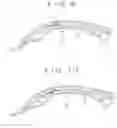 Fig. 07 - Method of molding synthetic resin guide for transmission device
