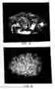 Fig. 04 - Compositions and composites of cellulosic and lignocellulosic materials and resins, and methods of making the same