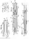 Fig. 05 - Radial-type temporary fastener, components and tool