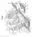 Fig. 07 - Paper sheet accumulating/feeding apparatus