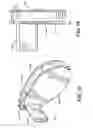 Fig. 02 - Motor with raised rotor