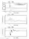 Fig. 12 - Damping for electromechanical actuators