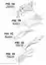 Fig. 02 - Medical scanning system and related method of scanning