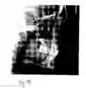 Fig. 08 - Soft tissue cephalometric screen with submental-neck extension, and radiology apparatus, modular system and imaging method using same