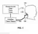Fig. 02 - Method and apparatus for improving hearing in patients suffering from hearing loss