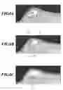Fig. 07 - Diagnostic imaging support apparatus and diagnostic imaging support method