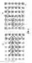 Fig. 05 - Local watershed operators for image segmentation
