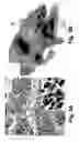 Fig. 04 - Enhancement of human epidermal melanogenesis