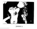 Fig. 09 - Apparatus and methods for enzymatic escharotomy in burn induced compartment syndrome