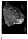 Fig. 02 - Dry mouldable drug formulation