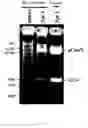 Fig. 07 - Nucleic acid amplification in yeast