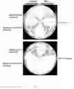 Fig. 09 - Nucleic acid amplification in yeast