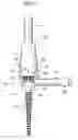 Fig. 06 - Spinal implant, driver tool and nut guide