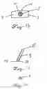 Fig. 03 - Follicular extraction punch and method