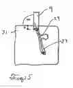 Fig. 10 - Follicular extraction punch and method