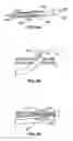 Fig. 06 - Surgical fastening system
