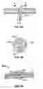 Fig. 07 - Surgical fastening system
