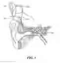 Fig. 02 - Electrical stimulation of the acoustic nerve based on selected groups