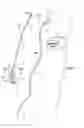Fig. 02 - Collapsible/expandable electrode leads