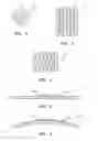 Fig. 03 - Collapsible/expandable electrode leads