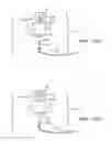 Fig. 09 - Collapsible/expandable electrode leads
