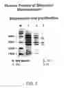 Fig. 06 - Methods for detecting Corpuscles of Stannius protein stanniocalcin