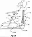 Fig. 33 - Upper body exercise and flywheel enhanced dual deck treadmills