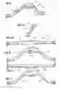 Fig. 04 - Treadmill mechanism
