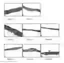 Fig. 04 - Compositions and methods for inhibiting abnormal cell growth