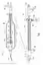 Fig. 06 - Apparatus and method for cryogenic inhibition of hyperplasia