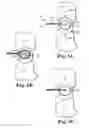 Fig. 09 - Multi-stage biomaterial injection system for spinal implants