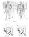 Fig. 03 - System and method for treatment of sexual dysfunction