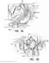 Fig. 02 - Methods and systems for electrical and/or drug stimulation as a therapy for erectile dysfunction