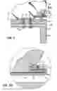 Fig. 04 - Mattress retainer bracket
