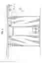 Fig. 09 - Drive tension sensor for a powered door